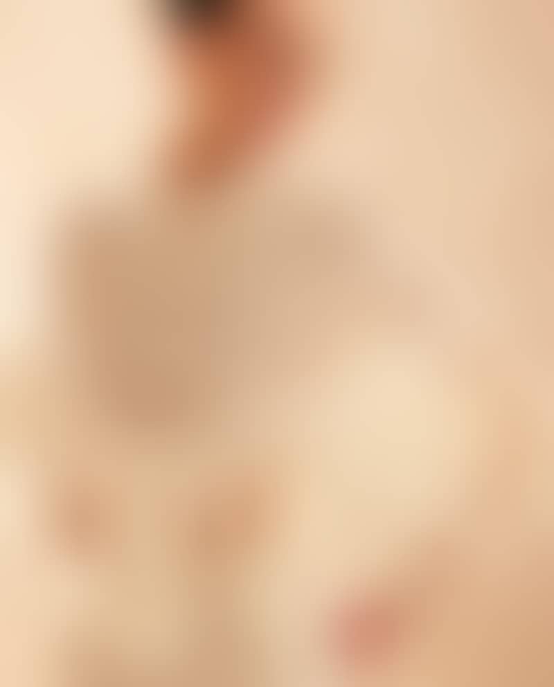 Image de la variation