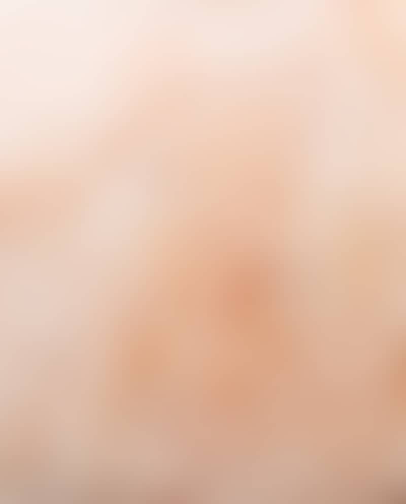 Image de la variation