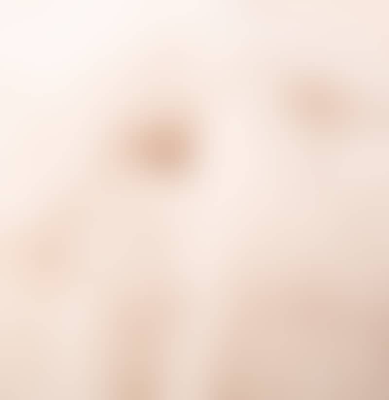 Image de la variation
