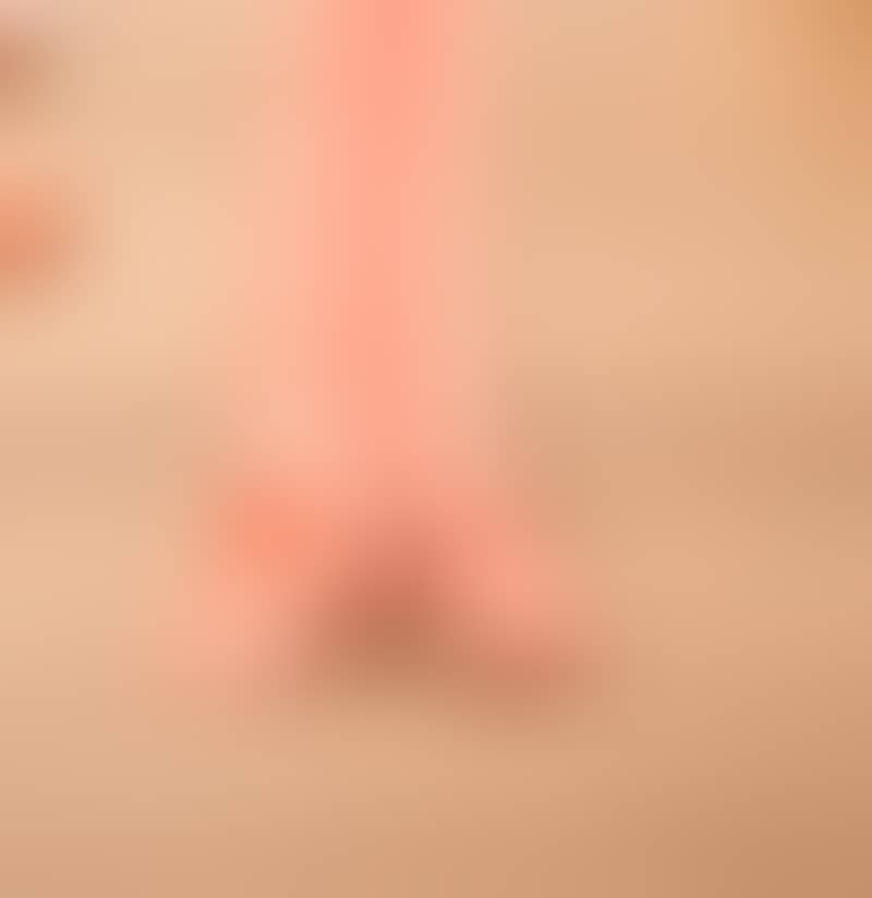 Image de la variation